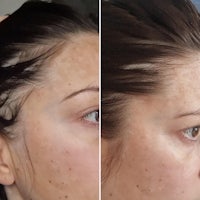 before and after photos of a woman's hair